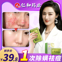 In addition to mite soap the back removes acne and removes mites There are acne marks on the back of the body the back of the body and Shanghai sulfur soap