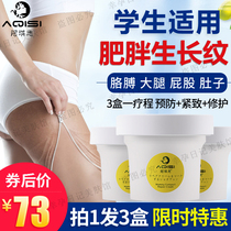 Anti-obesity growth lines Thigh butt male and female students Pregnant women special prevention removal of pregnancy and postpartum lines repair cream
